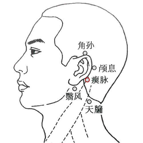 瘛脉 - 图片1
