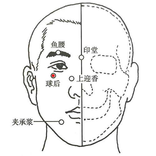 球后 - 图片1