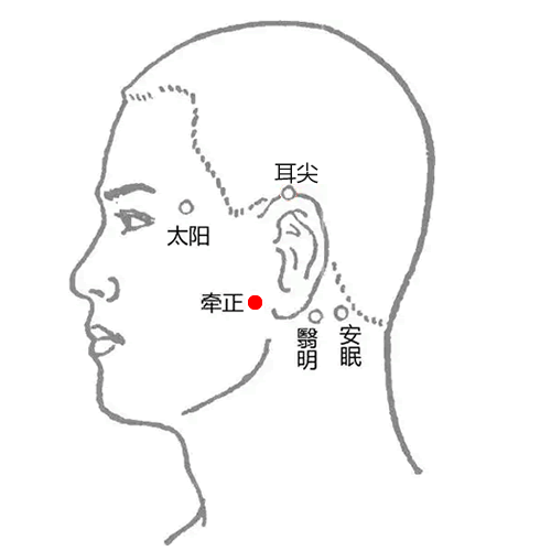 牵正 - 图片1