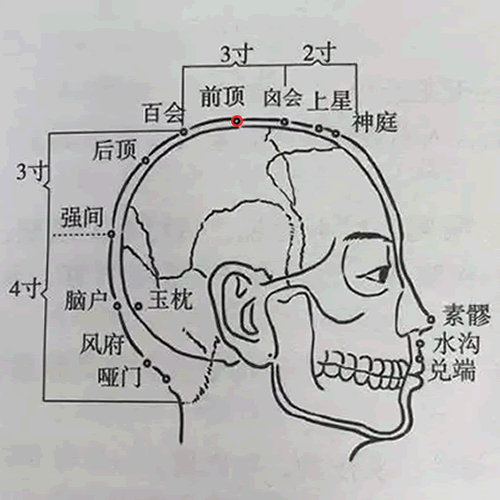 前顶 - 图片1
