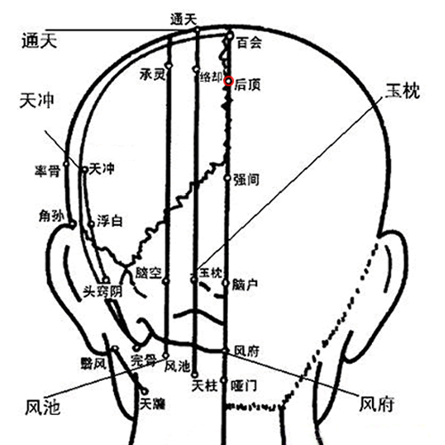 后顶 - 图片1