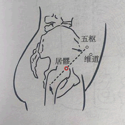 居髎 - 图片1