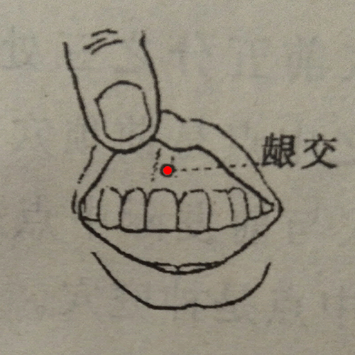 龈交 - 图片1