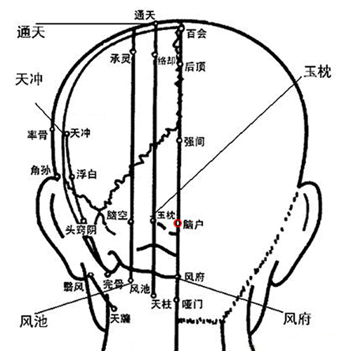 脑户 - 图片1