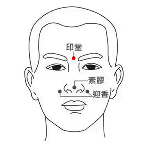 印堂 - 图片1