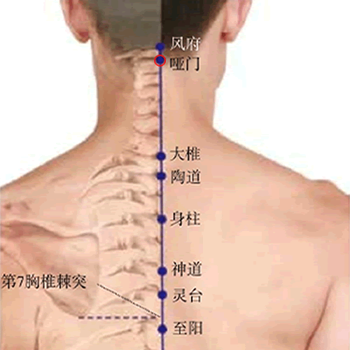 哑门 - 图片1
